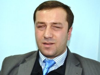 KORKUT’TAN TERÖRÜ KINAMA