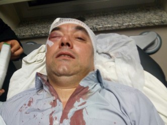 SÜLEYMAN BAYRAKTAR’I DARP EDEN ŞAHISLAR YAKALANDI