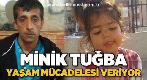 MİNİK TUĞBA  YETKİN YARDIM BEKLİYOR